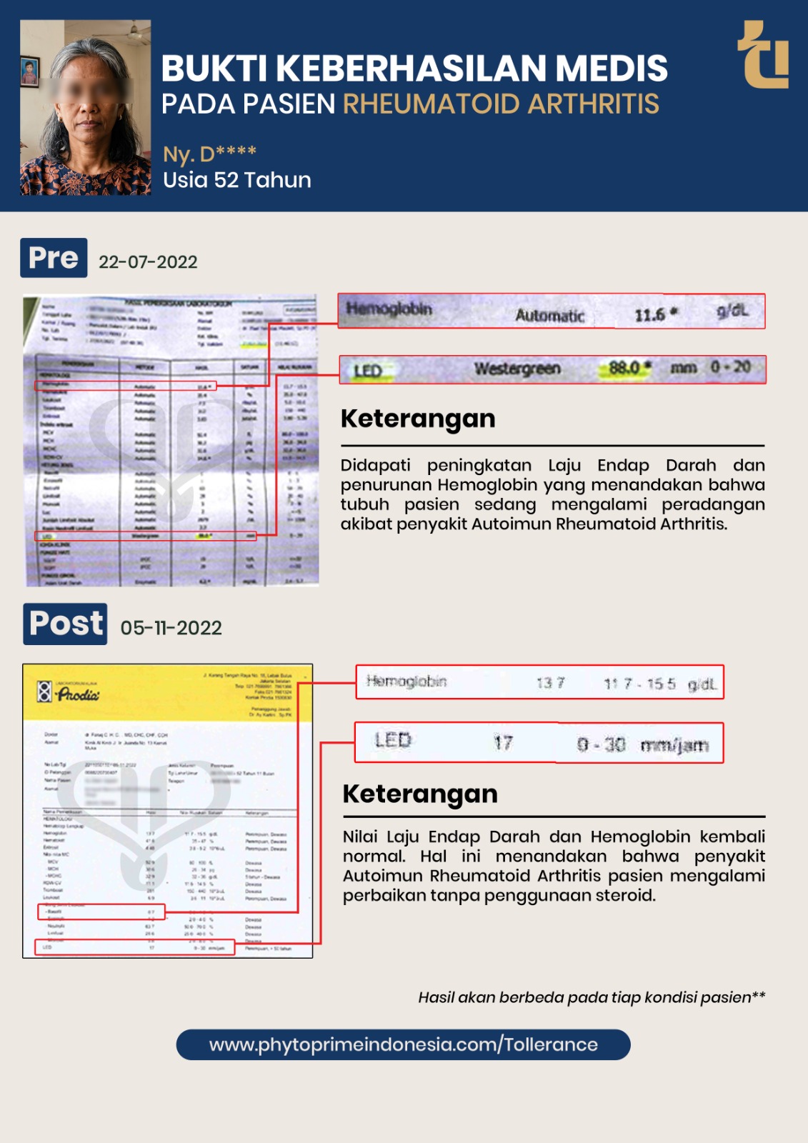 Bukti keberhasilan medis pasien kedua